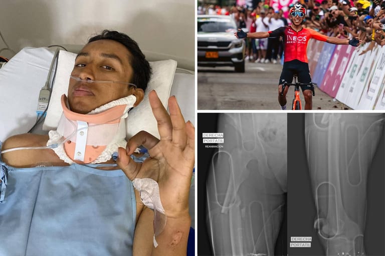 Egan Bernal’s near-death crash is now a medical case study